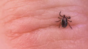 Tick Bite Paralyzes Fitness Enthusiast: A Wake-Up Call for Outdoor Safety