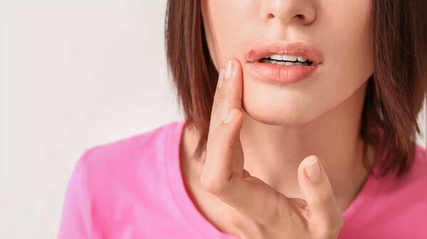 Recognizing sores that resist healing as a possible cancer sign