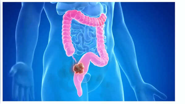 Sudden weight loss warrants medical attention