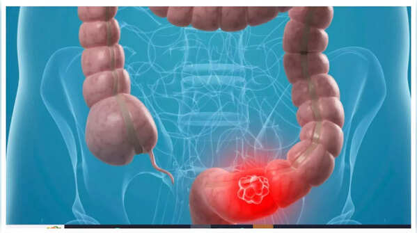 Don't ignore persistent abdominal pain