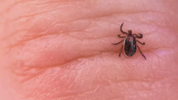 Close-up of a tick on skin